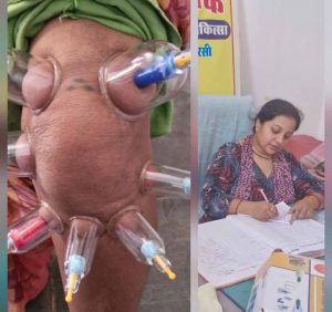 लोहरसी आयुर्वेदिक औषधालय में दर्द प्रबंधन हेतु कपिंग थेरेपी एवं विशेष आयुर्वेदिक उपचार सेवाओं का आरंभ