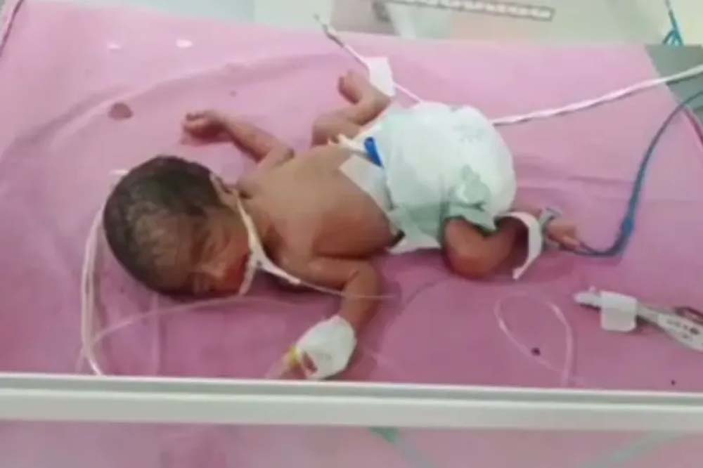 राजस्थान में दुर्लभ मामला, सिजेरियन से जन्मे तीन बेटियां और एक बेटा साथ राजस्थान में दुर्लभ मामला, सिजेरियन से जन्मे तीन बेटियां और एक बेटा साथ