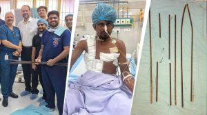 दर्दनाक हादसे के बाद मेडिकल चमत्कार, शरीर में धंसे 4 सरियों को KGMU के डॉक्टरों ने सफल ऑपरेशन से निकाला