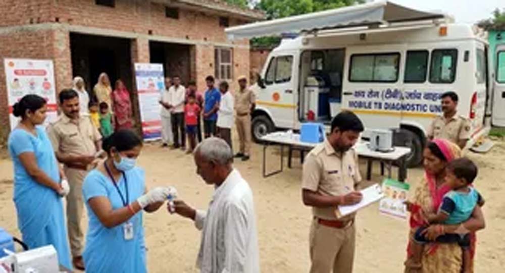 लक्षण बिना भी शरीर में छिपी रह सकती है टीबी, विशेषज्ञों ने दी जांच की सलाह