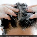 शैम्पू बदलने से नहीं रुकता हेयर फॉल? जानिए बाल झड़ने की असली वजह शैम्पू बदलने से नहीं रुकता हेयर फॉल? जानिए बाल झड़ने की असली वजह