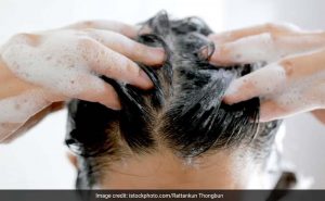 शैम्पू बदलने से नहीं रुकता हेयर फॉल? जानिए बाल झड़ने की असली वजह शैम्पू बदलने से नहीं रुकता हेयर फॉल? जानिए बाल झड़ने की असली वजह