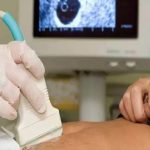 मध्य प्रदेश में ई-वाउचर से मिलेगी कैशलेस सोनोग्राफी, सरकारी सुविधा न होने पर निजी सेंटर में होगी मुफ्त जांच