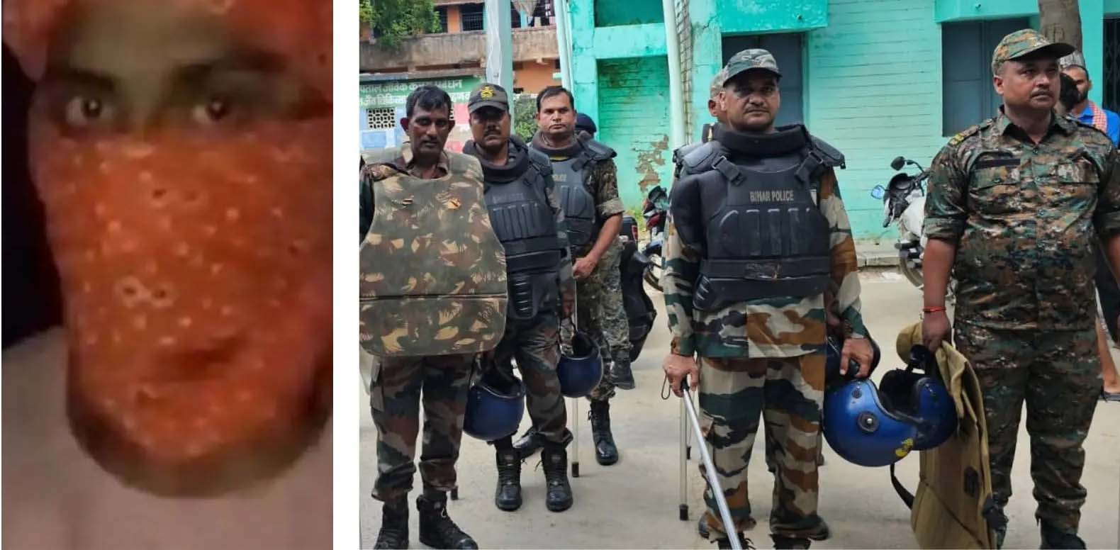 वायरल वीडियो से खुला जमुई कांड का राज, पुलिस मुठभेड़ में मुख्य आरोपी नंदन यादव घायल