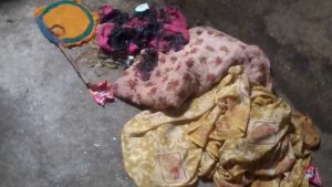 घर में अचानक भड़क रही आग से दहशत! डबरा में 3 दिन से कपड़े-बिस्तर जलने का सिलसिला