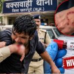 गिरफ्तारी से बचने के लिए आरोपी ने पुलिसकर्मी के हाथ पर काटा, HIV संक्रमण की पुष्टि गिरफ्तारी से बचने के लिए आरोपी ने पुलिसकर्मी के हाथ पर काटा, HIV संक्रमण की पुष्टि
