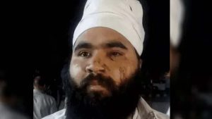 पूर्व कांग्रेसी नेता जगजोत सिंह पर हमला, हमलावरों ने काटे बाल
