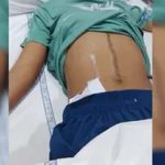स्कूल में मामूली विवाद ने लिया हिंसक रूप, छात्र ने कुर्सी से किया हमला; 22 टांके लगे