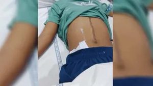 स्कूल में मामूली विवाद ने लिया हिंसक रूप, छात्र ने कुर्सी से किया हमला; 22 टांके लगे